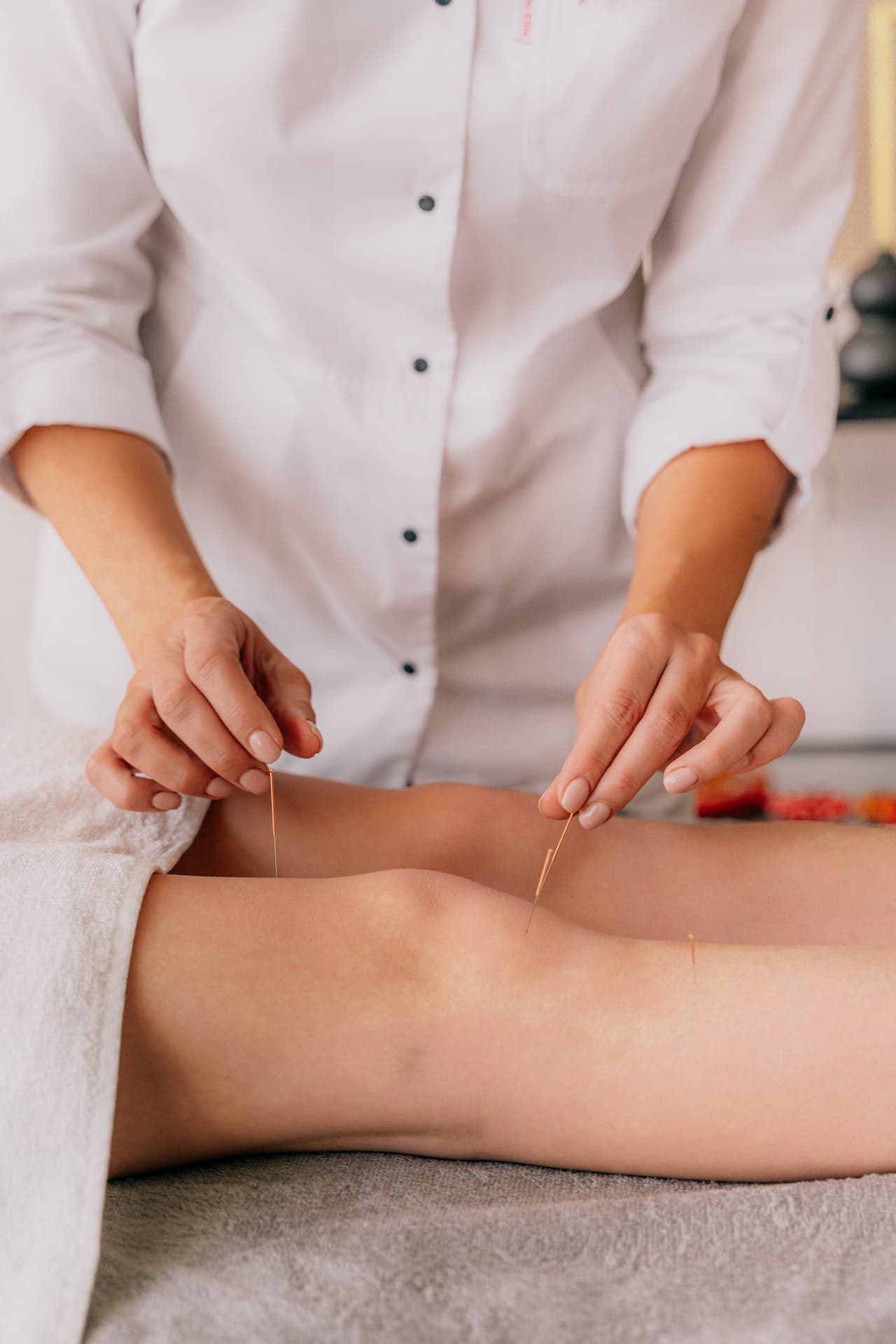 Acupuncture treatment for knee pain