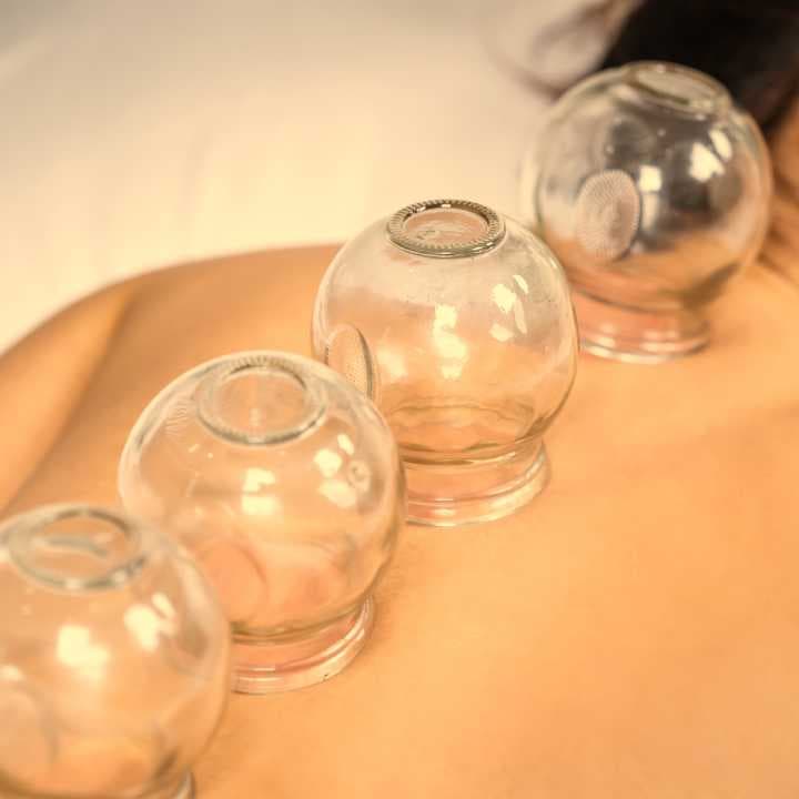 Cupping Therapy