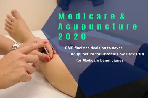 Acupuncture Medicare Coverage for Low Back Pain 2020